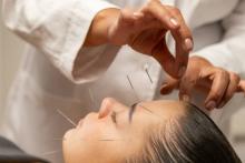 Acupuncture ivf support Hertford ware