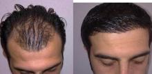 hair 