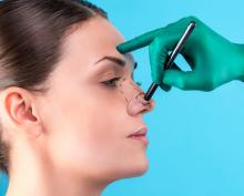 rhinoplasty