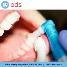 Dental Implants in Madison