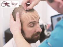 Highest Quality Hairpieces from best manufacturers, such as: On Rite,Ortech, Hair vision Int’l and New Image