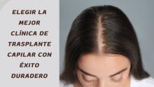 clinica de trasplante capilar