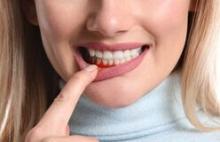 Gum disease treatment in Paschim Vihar.