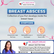 Breast Sebaceous Cyst Removal Surgery
