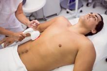 best laser hair removal for men