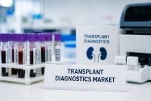 Transplant Diagnostics Market Size