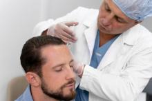 Hair replacement near me