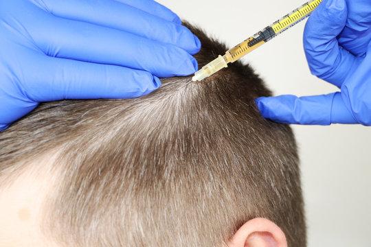 PRP Hair Treatment in Dubai