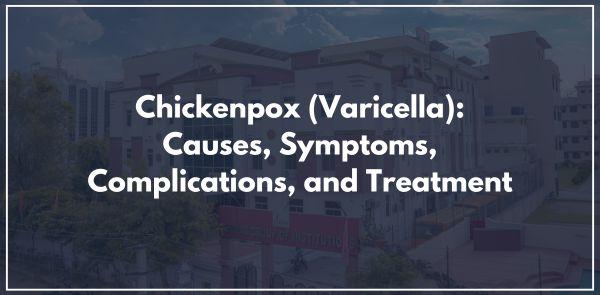 Chickenpox (Varicella): Causes, Symptoms, Complications, and Treatment