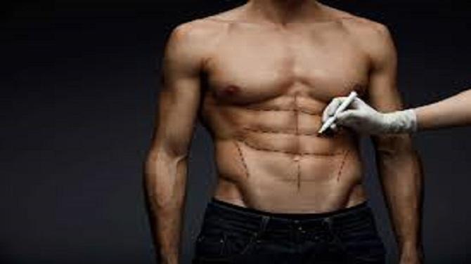 شفط الدهون في الرياض