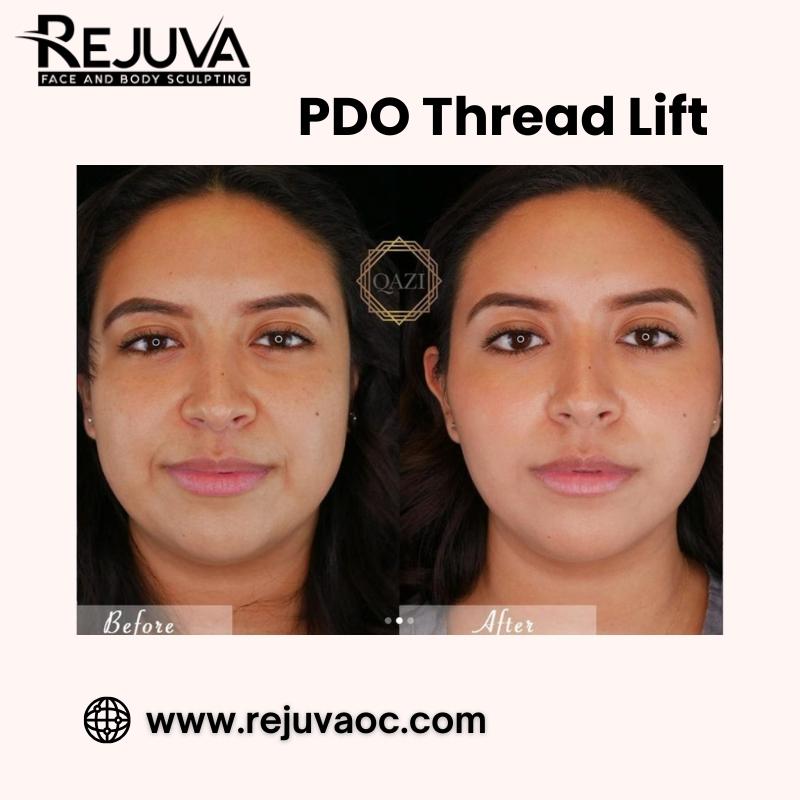 PDOThreadLift, NewportBeachAesthetics, Rejuvaoc, YouthfulSkin, NonSurgicalLift, SkinTightening, FacialRejuvenation, AntiAgingTreatment,