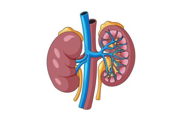 Kidney transplant