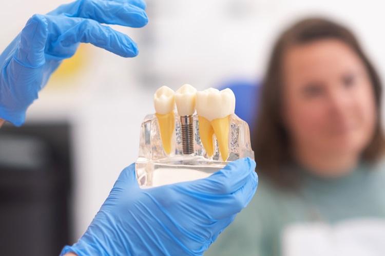 dentist holding a dental implant