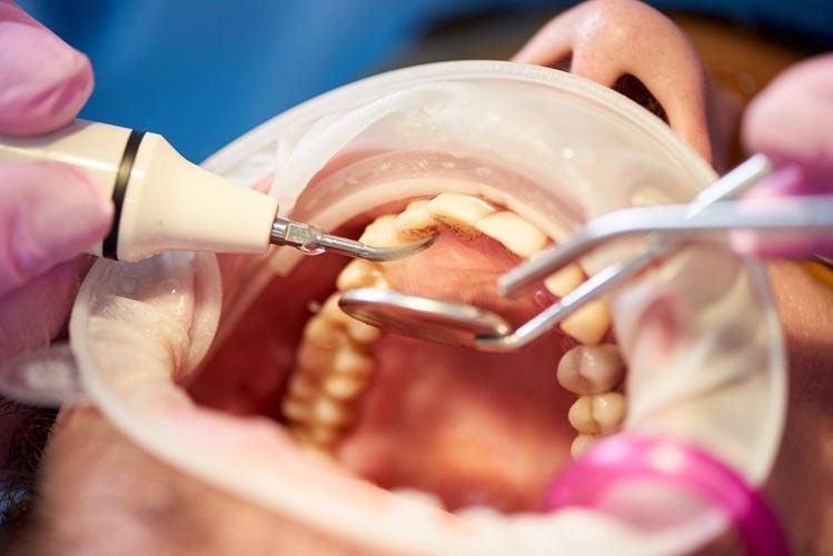 examination-of-a-patient-at-a-dental-office-florence