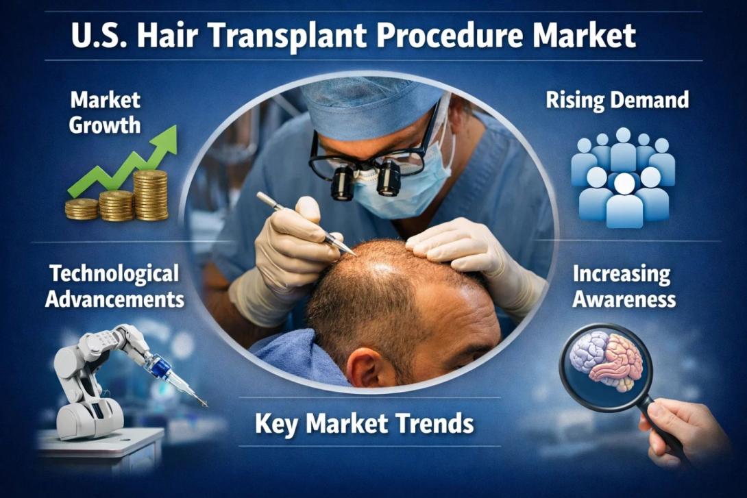U.S. Hair Transplant Procedure Market Size